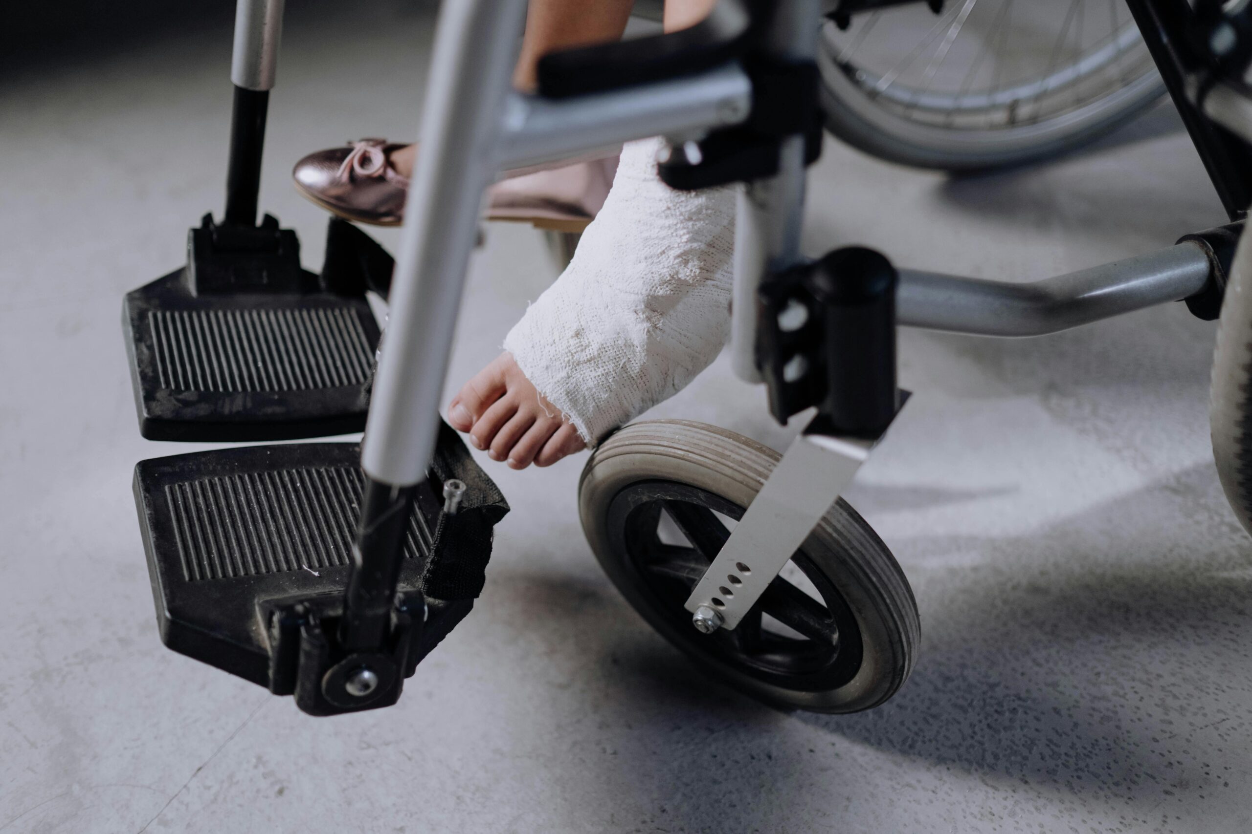 Close-up of an injured foot in a cast resting on a wheelchair, indoors.